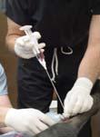guided injection of platelet rich plasma (PRP)