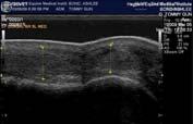 Ultrasonography Conclusion Traumatic injury