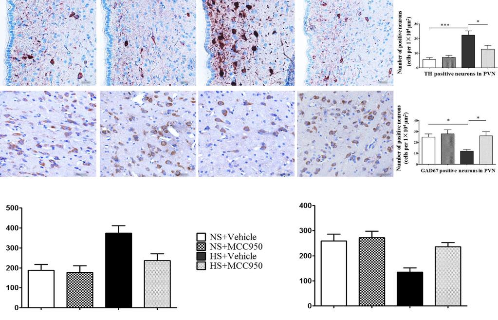 Wng et l. Journl of Neuroinflmmtion (2018) 15:95 Pge 10 of 12 c d e Fig. 9 Centrl lockde NLRP3 regultes PVN excittory nd inhiitory neurotrnsmitters.
