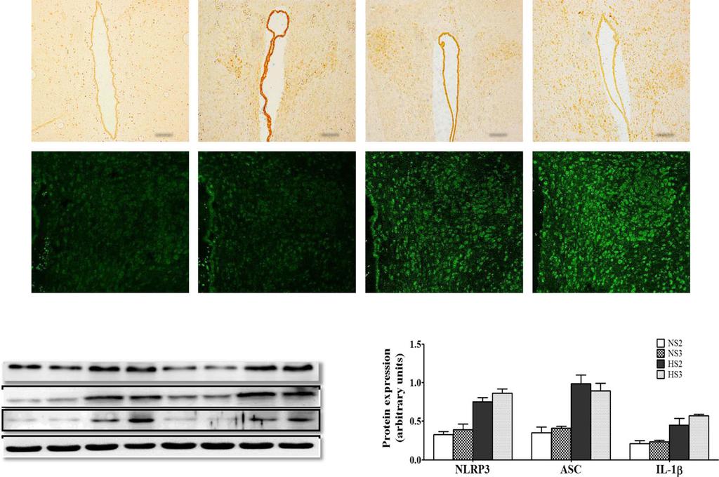 Wng et l. Journl of Neuroinflmmtion (2018) 15:95 Pge 5 of 12 c Fig. 2 The expression of NLRP3 pthwy protein in PVN.