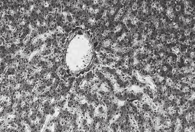 1 (a) Fig. 2.1 is a photomicrograph through the centre of a lobule of a mammalian liver.