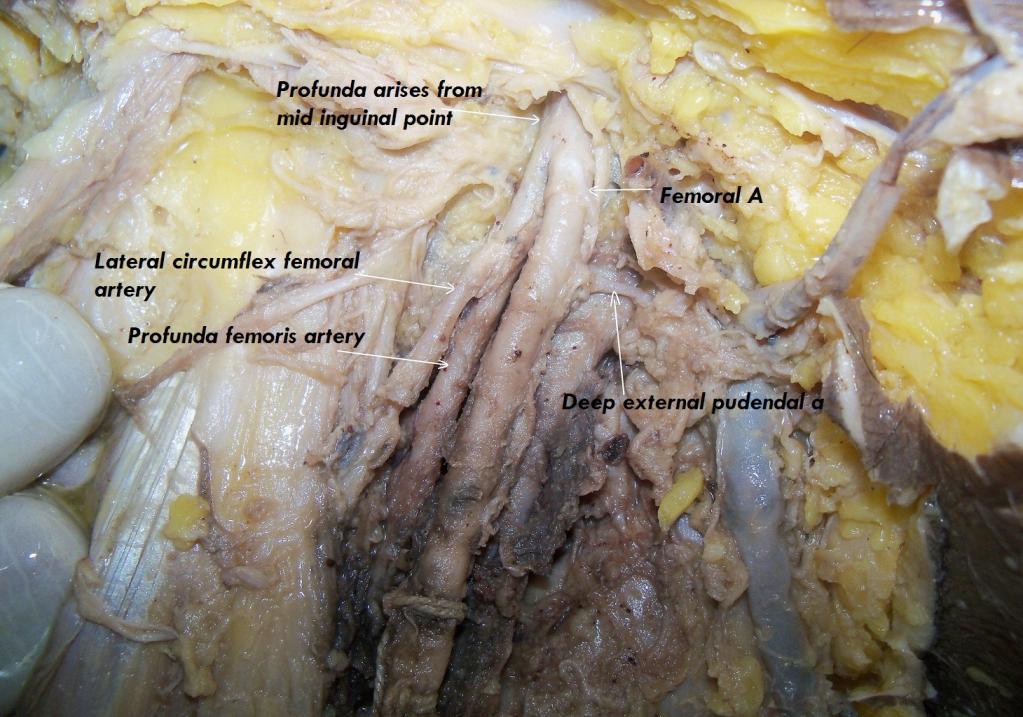 circumflex femoral artery arises.