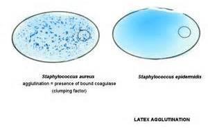 Coagulase testing Staphylococcus aureus produces the enzyme coagulase, while other Staphyloccus sp. generally do not.