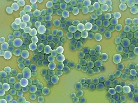 Staphylococcus saprophyticus Part of the normal micro-flora of the female genital tract Common cause of community-acquired urinary tract infections