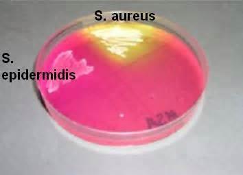 Mannitol salt agar Combination of selective and differential medium. It contains high salt concentrations (<7.5% NaCl), which inhibits most bacteria except for Staphylococci (and few others).