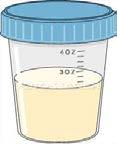 urine is a poor sample Frees clinician time, may