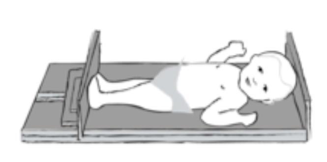 Measuring length and height Length: Recumbent position using calibrated lengthboard Fixed