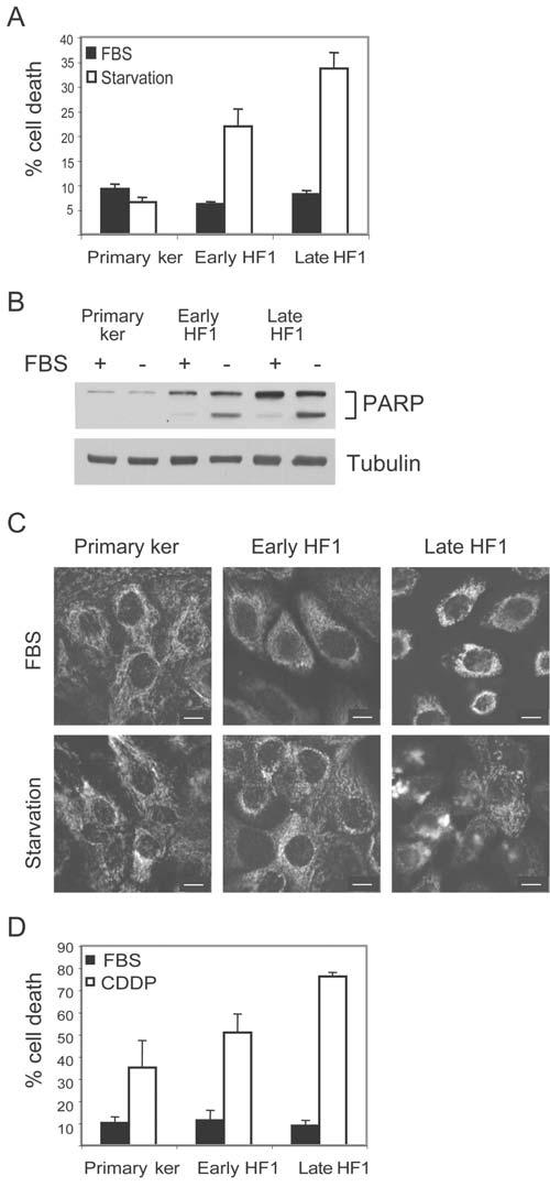 affected by starvation, PARP was not cleaved. PARP was clearly cleaved upon starvation of early HF1 cells and even more dramatically in late HF1 cells (Figure 2B).