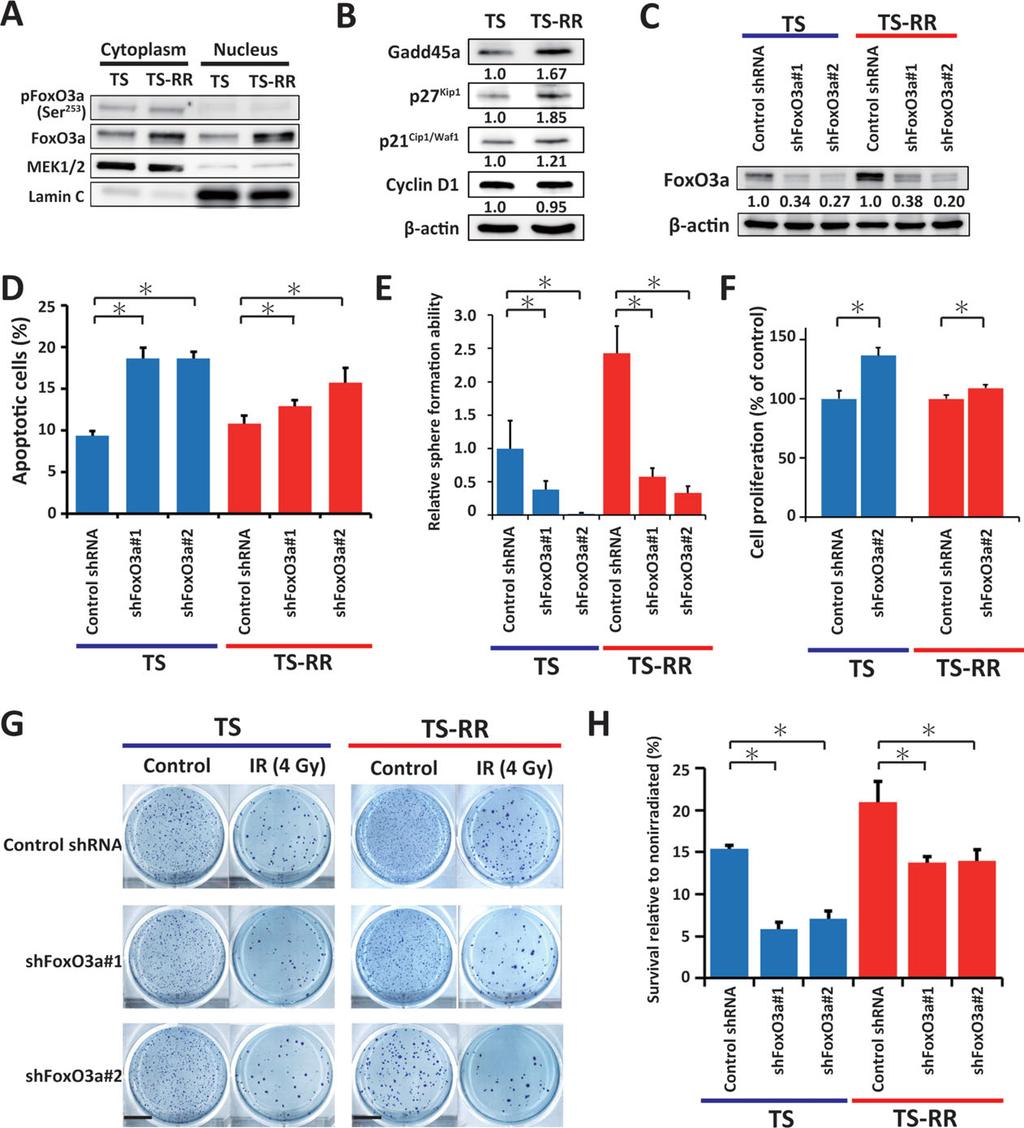634 IGF1R Signaling Regulates Radioresistance in GSCs Figure 5. Fractionated radiation induces FoxO3a-mediated self-renewal and slow proliferation in glioma stem cells.