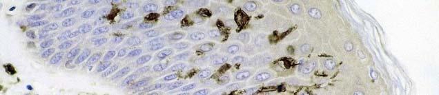 3) Langerhans cells (LC) Found in the