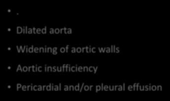 . Aortic Dissection 2D-Echo Findings Hallmark: dissection flap Dilated aorta