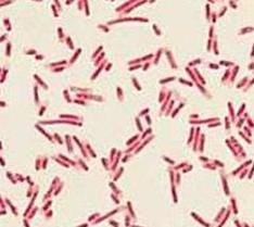 (19,200/2 6 x 300/64 x300) 4. (10 pts) A. What staining method is commonly used to differentiate between bacteria? Gram stain B.