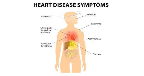 Signs and Symptoms of a Heart Attack The five major symptoms of a heart attack are Pain or discomfort in the jaw, neck, or back. Feeling weak, light-headed, or faint. Chest pain or discomfort.
