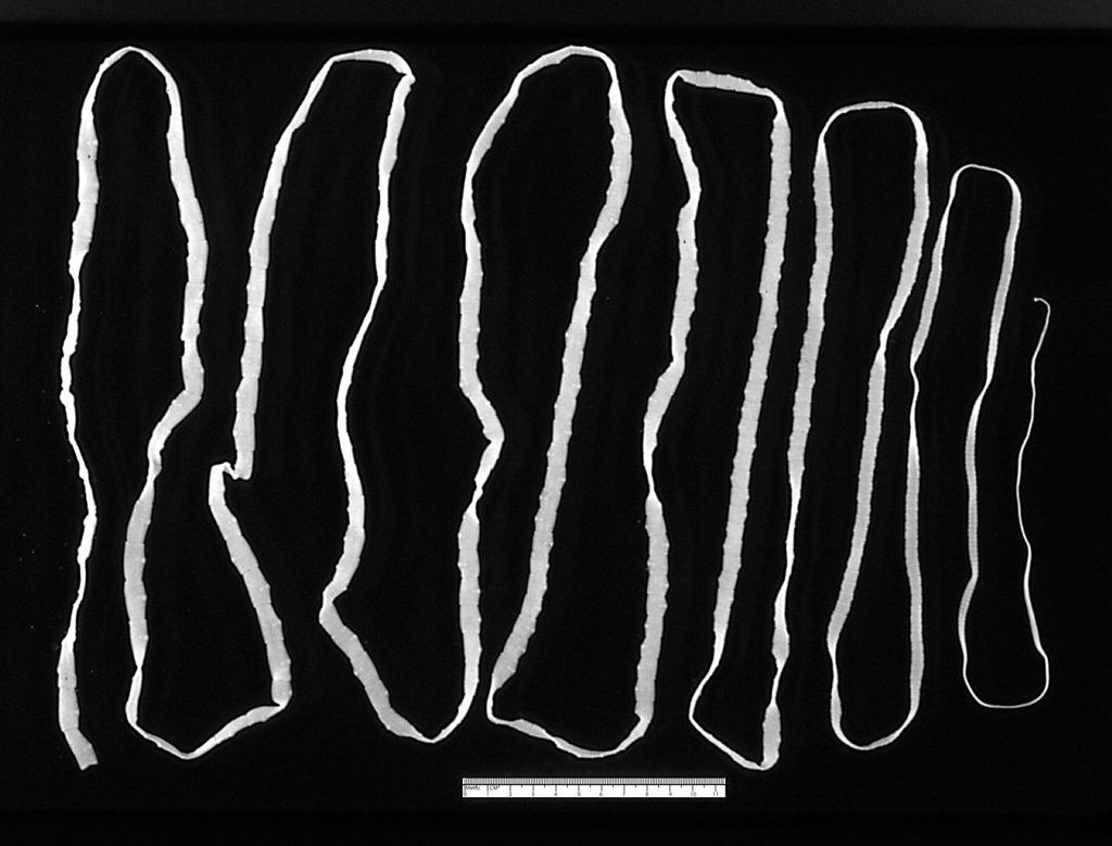 10: Adult tape worm (Taenia saginata). Source: Reprinted from CDC Public Health.