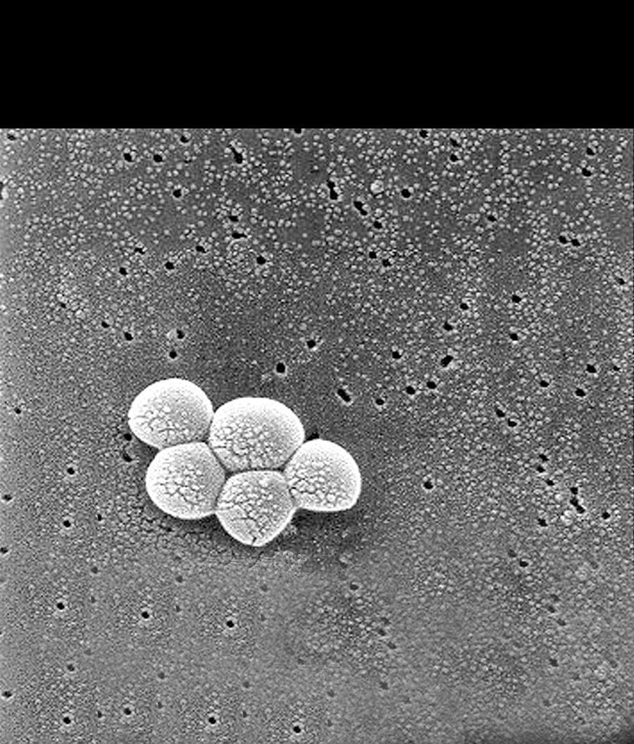 06: Scanning electron micrograph of Staphylococcus aureus bacteria. Source: Reprinted from Centers for Disease Control and Prevention.