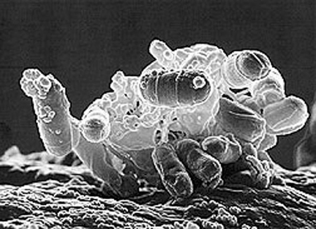 07: A cluster of E. coli bacteria. Source: Reprinted from US Department of Agriculture, Agricultural Research Service.