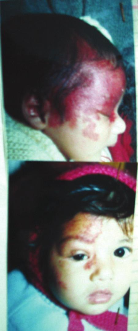 Page 23 D O N O T D U PL these lesions, both as a guide for the surgeon and for conservative follow-up.