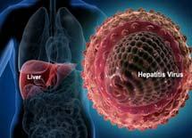 A clinical syndrome of variable severity caused by hepatitis A (HAV), B (HBV), C (HCV), D