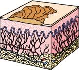 Secondary Skin Lesions Crust Collection of cellular