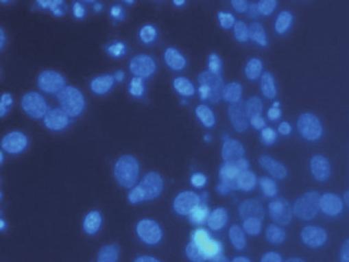 microscopy ( 200) at 48 h after transfection.