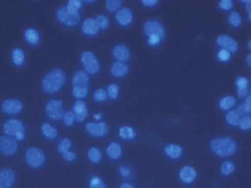 Untreated cells (A); negative sirna (B); MTX (C); negative sirna + MTX (D); scrambled