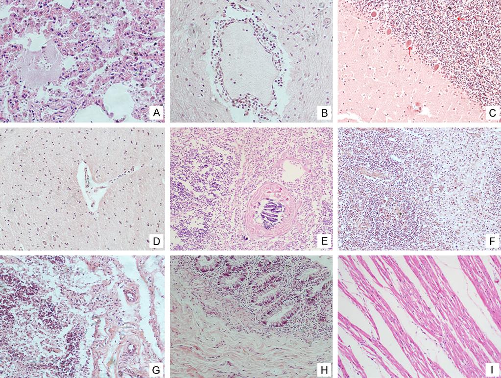 Figure 1. Histological findings of the main tissues of the autopsy.