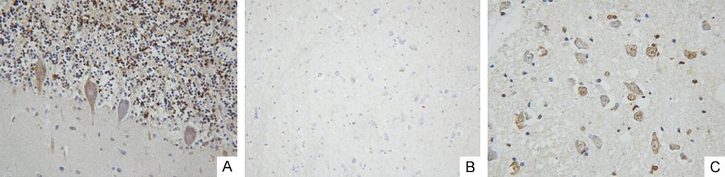 Figure 2. Detection of VP1 protein of EV71 by immunohistochemistry staining method.
