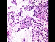 Myoepithelial Cells Plasmacytoid Spindle