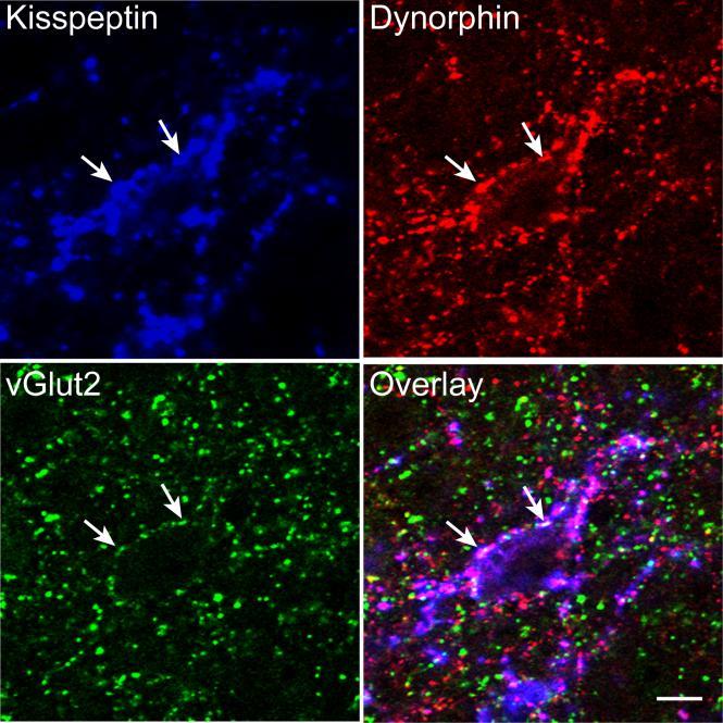 119 Figure 5.1. Confocal images (1 μm thickness; 63x) of triple-labeling for kisspeptin (blue), dynorphin (red) and vglut2 (green) in the ARC.