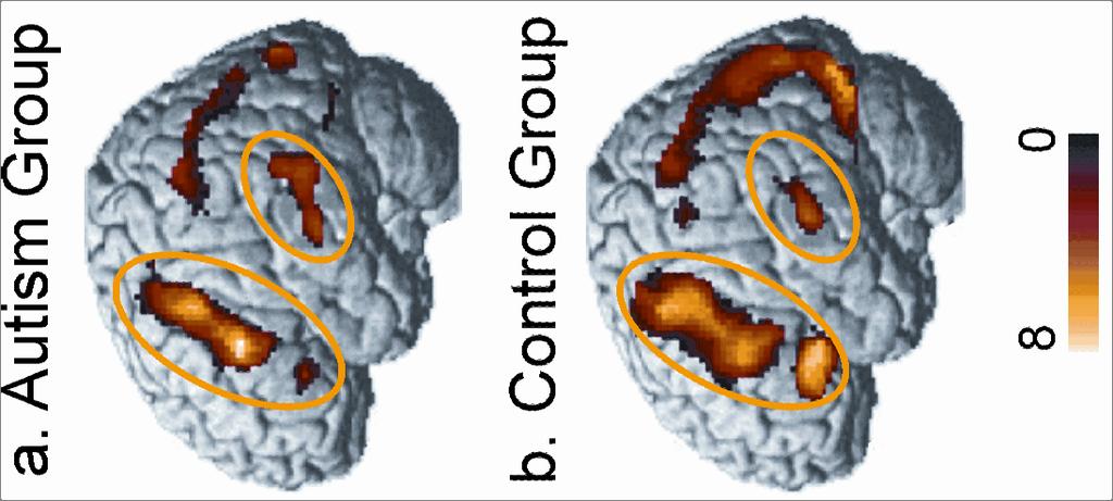 Brain activation during sentence comprehension in autism In Brain, 2004 Autism group has less activation in Broca s area (a sentence integration area) than the control group