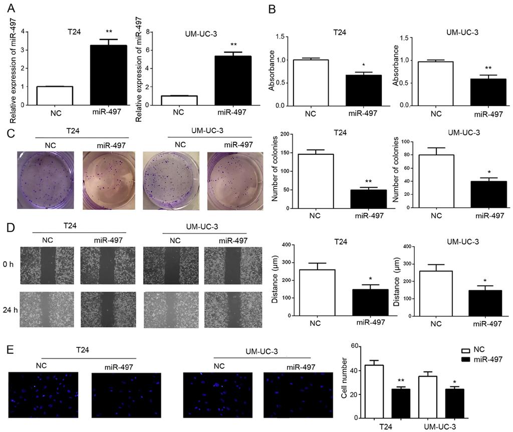 1296 zhang et al: New biomarker for bladder cancer Figure 2. In vitro tumor-suppressing effect of mir-497.