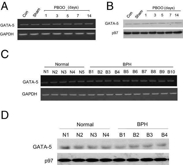 2246 Boopathi et al Figure 9. GATA-5 profiling in normal and obstructed hypertrophic BSM in mice and human beings.