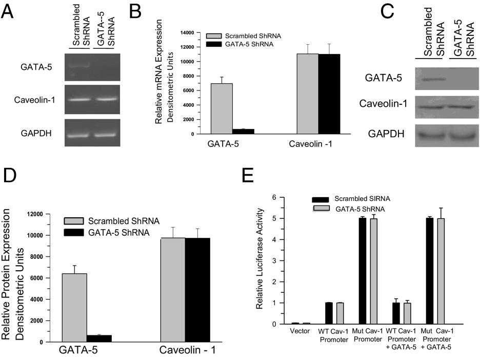2248 Boopathi et al Figure 13. GATA-5 (GATA5 ) silencing did not affect caveolin-1 (CAV1) gene expression and transcriptional activity in human BSM cells.