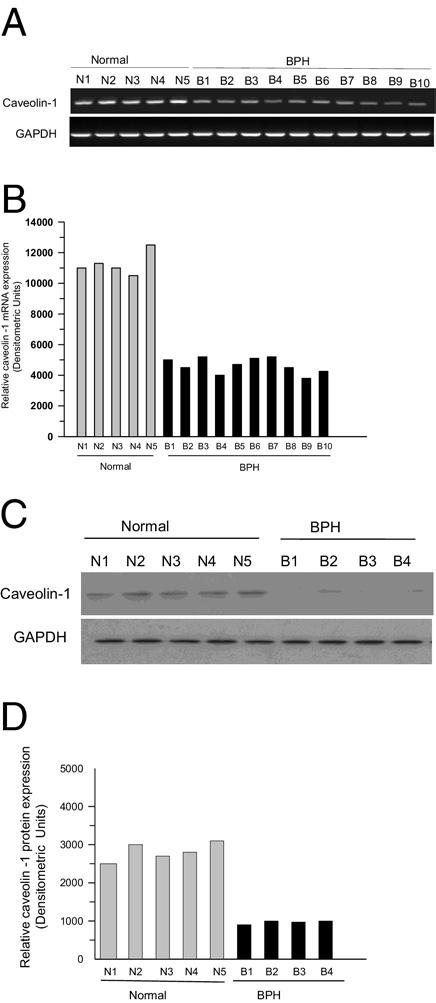 2240 Boopathi et al PCR-amplified murine GATA6 cdna was cloned into the pcmv4 vector. GATA-5 cdna (OriGene Technologies, Inc., Rockville, MD) was used in cotransfection experiments with CAV1 promoter.