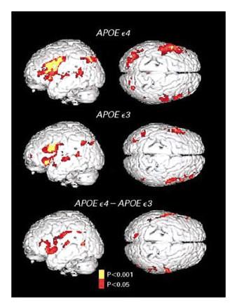 Memory Activation & APOE ε4 Major Risk gene for Alzheimer dx 16 APOE ε4 14 APOE ε3 APOE ε4 allele carriers had