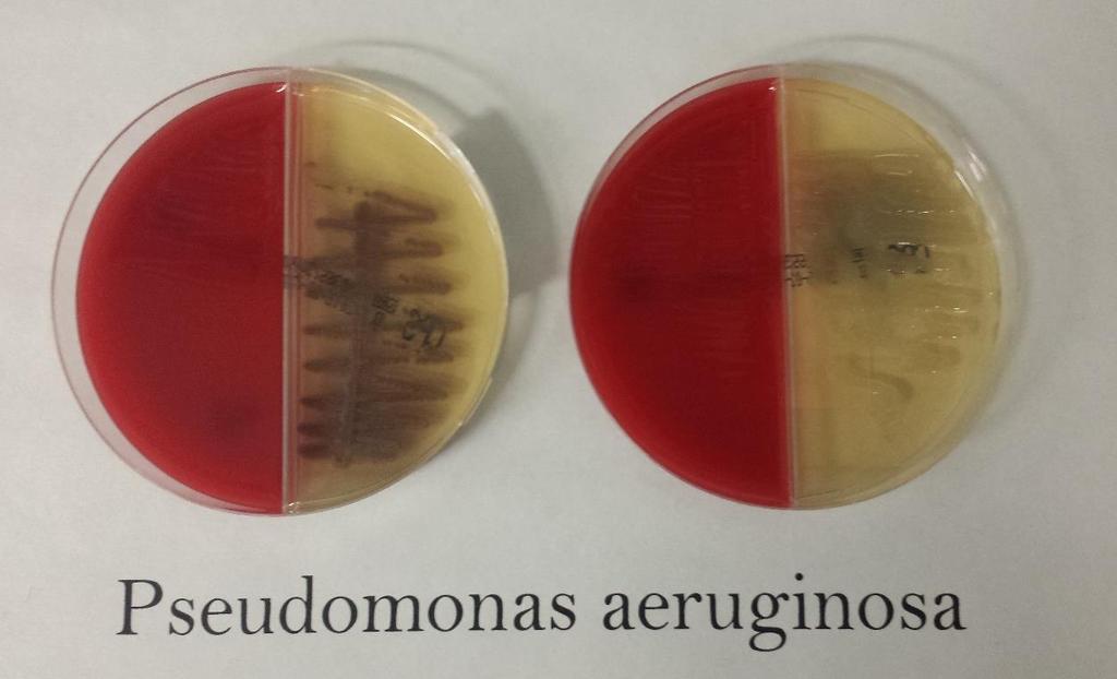 Requires Vitek MS identification and antimicrobial sensitivities if of significant amount. Figure 3: Left P. aeruginosa, Right mucoid P.
