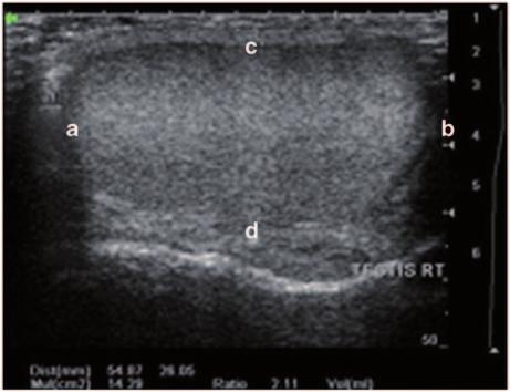 3 Physical Principles of Ultrasound of the Male Genitalia 65 Fig.