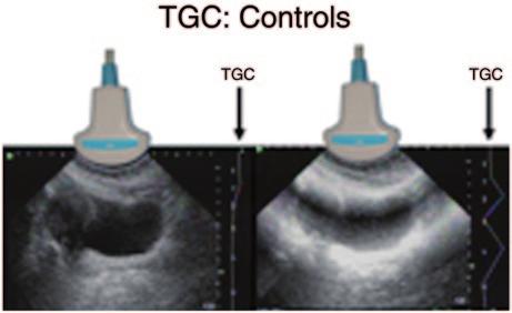 3 Physical Principles of Ultrasound of the Male Genitalia 67 Fig.
