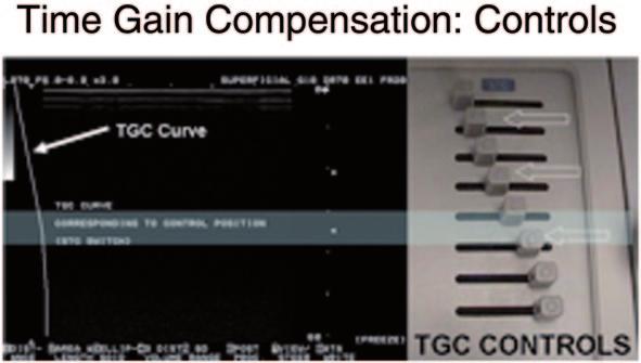 The physical sliders ( open arrow) correspond to the shape of the TGC curve ( white arrow) on the monitor (Fig. 50) Fig.