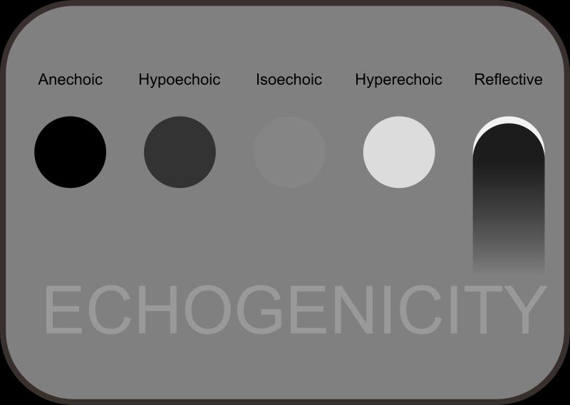 Terminology - Echogenicity It s all relative Take into context the surrounding