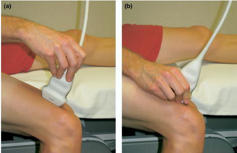 Transducer positioning Stabilize transducer with simultaneous contact with the transducer, skin surface, and examiner s hand maintains proper pressure