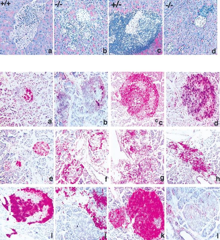 The Journal of Immunology 4579 A B C FIGURE 2. NOD/CIITA-deficient mice develop pancreatic infiltrates but not diabetes.