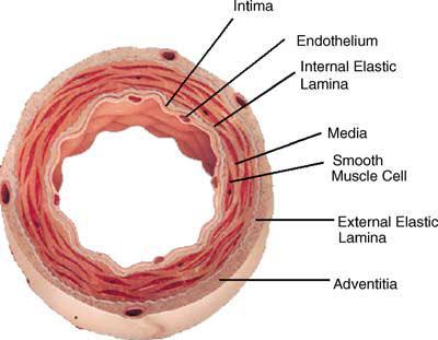1. Injury to the vascular endothelium