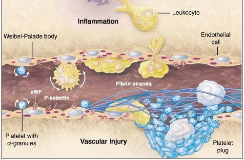 Injury to the vascular endothelium during endograft implantation. Inflammation plays a critical role in the vascular response to injury.