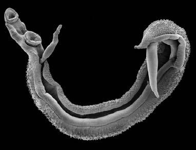 Schistosoma haematobium Intestinal: S.
