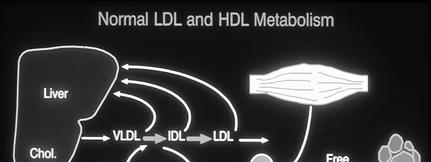 Macrophage HDL HDL Causes