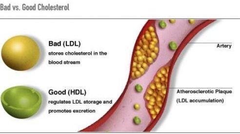 HDL vs.