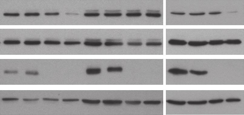 N-RAS shrna + + + + + + + + + + + + p-erk Y24 Total ERK N-RAS % Of cells in sub-g1 6 4 2 N-RAS shrna + + + + + N-RAS Q61K + + p-erk Y24 Total ERK 3 p27 Kip1 Cyclin D1 p-prb S87/811 N-RAS Q61K % cells