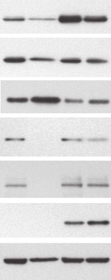 1 short hairpin RNA (shrna; þ ) or control ( ) shrna. At 5 days after transduction, cells were treated with DMSO ( ) or 1 nm ( þ ) for an additional 72 hours.