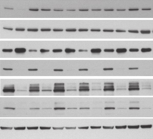 cells in sub-g1 +GSK-MEKi + + + + + + p-erk Y24 Total ERK p27 Kip1 Cyclin D1 p-prb S87/811 Total prb Figure 6.